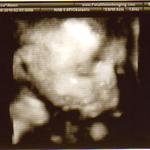 29 Weeks~ Look at my baby's cheeks :)
