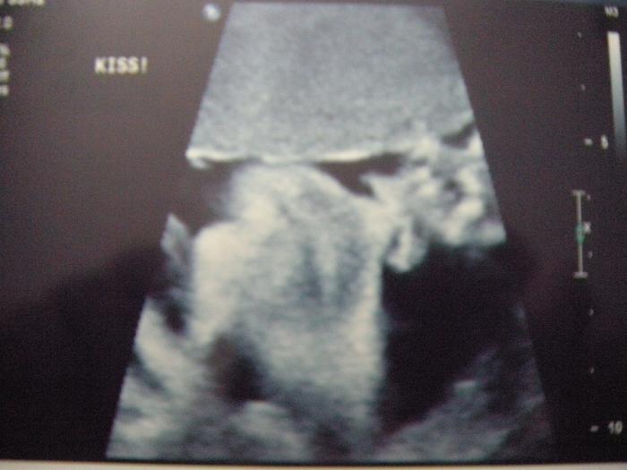 his adorable little lips and his hand on his nose! (30 weeks)