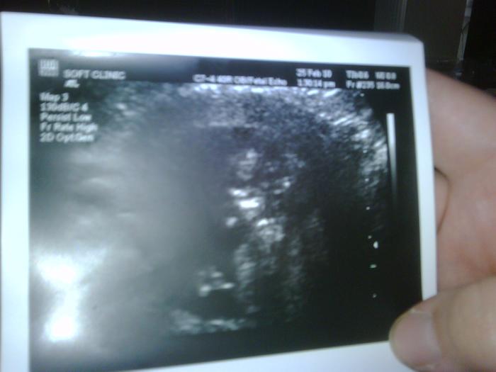 Baby J at 12 weeks