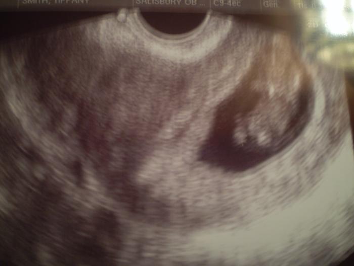 Our baby! Due Oct. 5, 2010