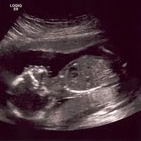 Profile picture at 19 weeks. 