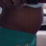 My belly today makes 5 weeks after I had chinese