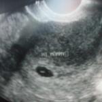 First Ultrasound my little pumkin