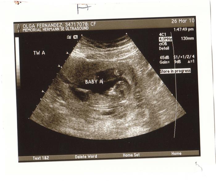 3rd ultrasound