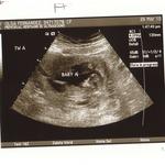 3rd ultrasound