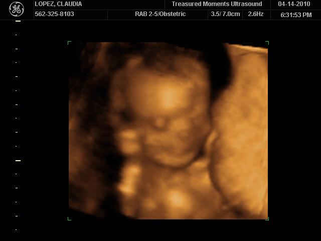 Our baby girl's face