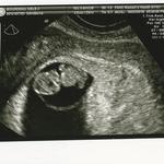 Our newest pouchling! 8w3d