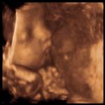 this is my beautiful baby Zoë in the womb!