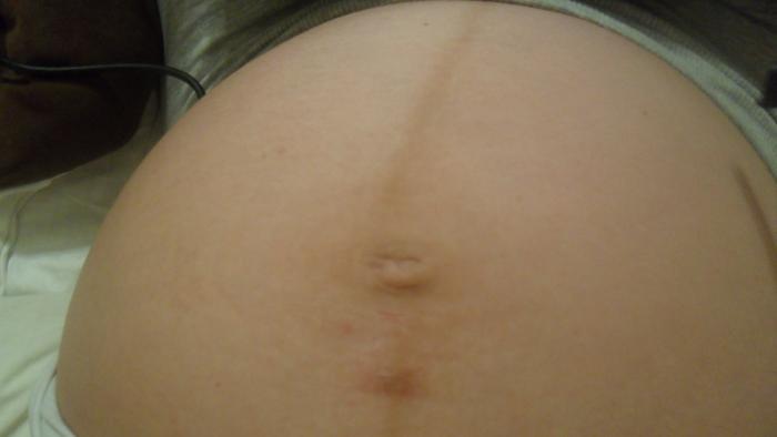 and now its gone..hmm..stretch mark?