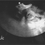 Head's on the left and body on the right 11w1d