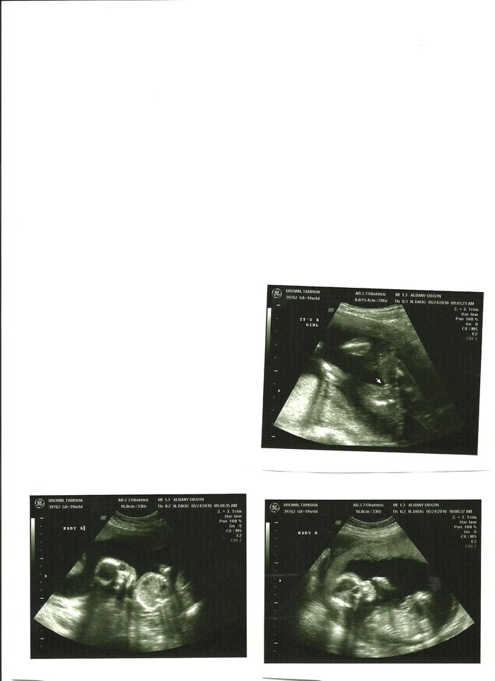 Ultrasound Pics from 5/24/2010