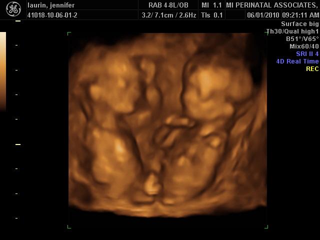 4D/ 13 weeks 1 day
