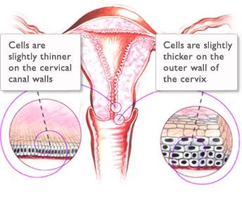 A healthy cervix