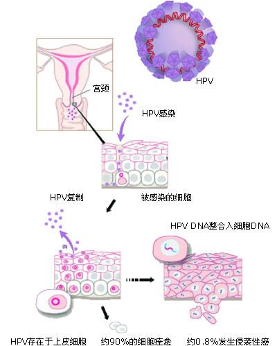 the process of HPV integrative into the normal cell