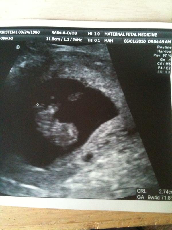 my baby at 9w4d