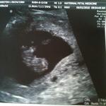 my baby at 9w4d