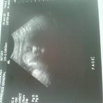 My ultrasound on 06/16/10. Jeyden at 37wks 5 days. Finally let me see his face.