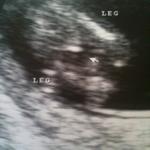 12w5d between the legs....cast your vote