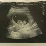 10w3d Baby A, baby B didnt want it's pic taken :)