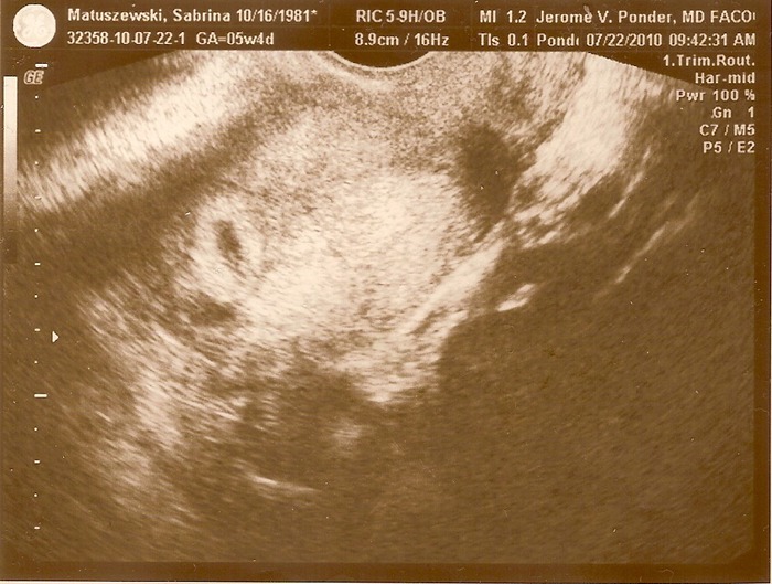 my first ultrasound of my little jelly bean 