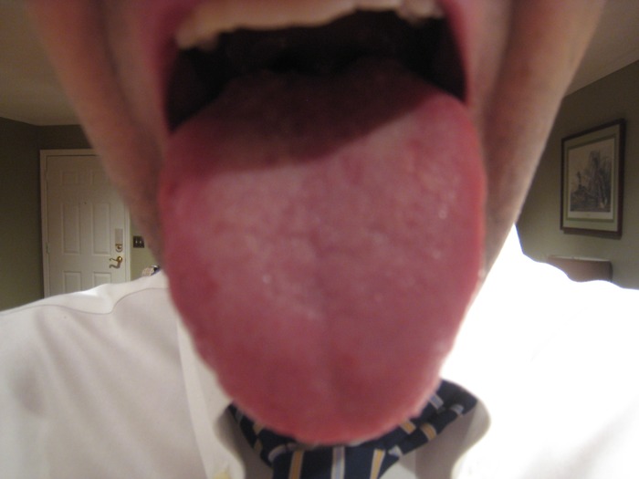 My Tongue