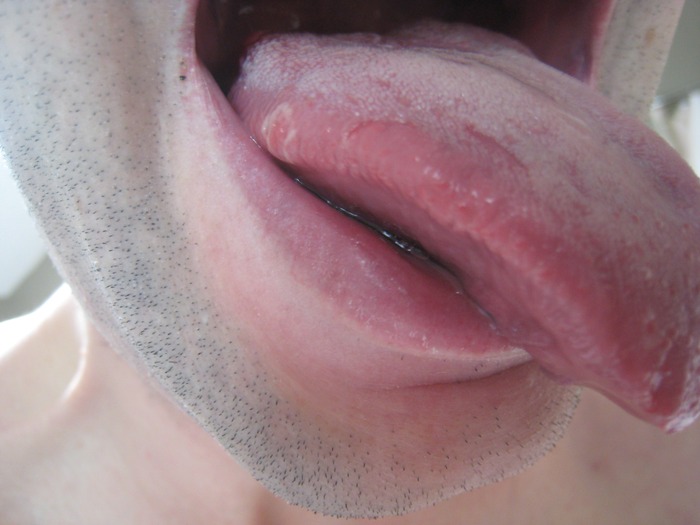 my tongue