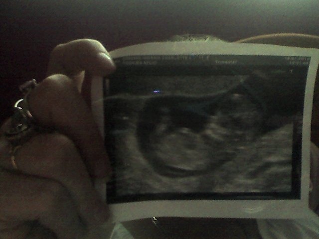 baby 12 weeks 