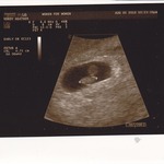 Baby's First Picture - HB 131--I think this one might be a boy :)