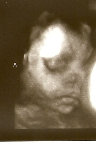 Finally 4D glimpse of baby A, he has been harder to photograph then baby just bc of his location