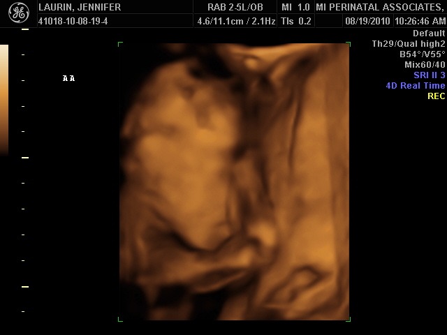 covering his face 24 weeks
