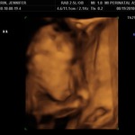 covering his face 24 weeks