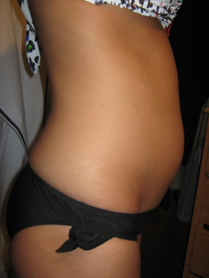 2 months July 7th, 2010..more bloated than baby here LOL