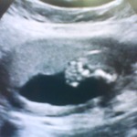My baby's lil foot