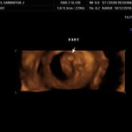 1st ultrasound, 9wks, 4days