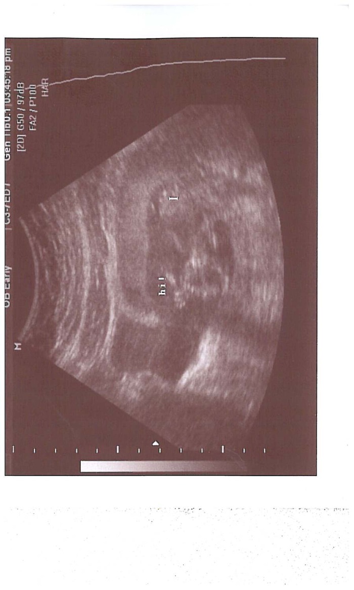 My baby can wave AND say HI already!!!