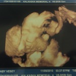 Baby B 3D 27 weeks