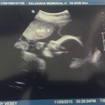 Baby B 27 weeks