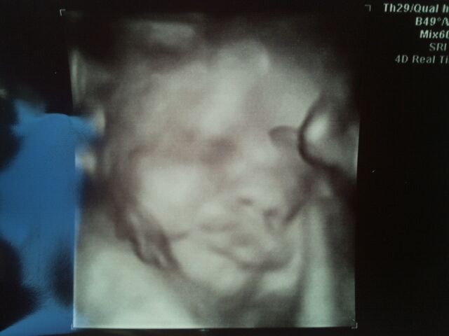 Baby Boy 33 weeks