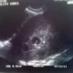 The top one with the little white line partially through it, is the one we got the heartbeat for. 