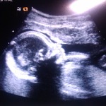 20 week ultrasound, 13 ounces