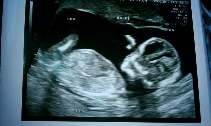 13 weeks 6 days Baby boy