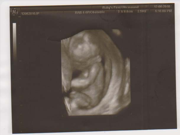 The cute 3d pic 15 wk 6 days