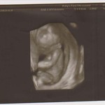 The cute 3d pic 15 wk 6 days