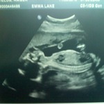 it's a girl!