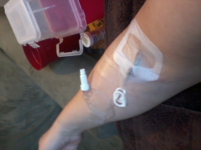 my inhome IV for the steroid treatment