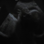 the fuzzy blur over her profile is her hand on her face all fisted up :)