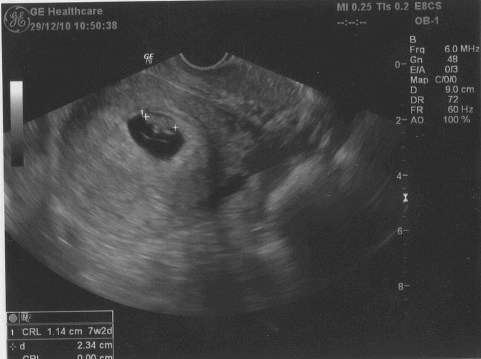 Our baby, mommy and daddy love you SO much!