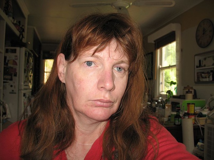 This is the Face of Thyroid Disease! Jan 2 2010