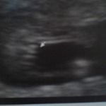 Its a GIRL