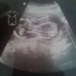 very blury pic of the ultrasound i recieved of bubs spine and back!!